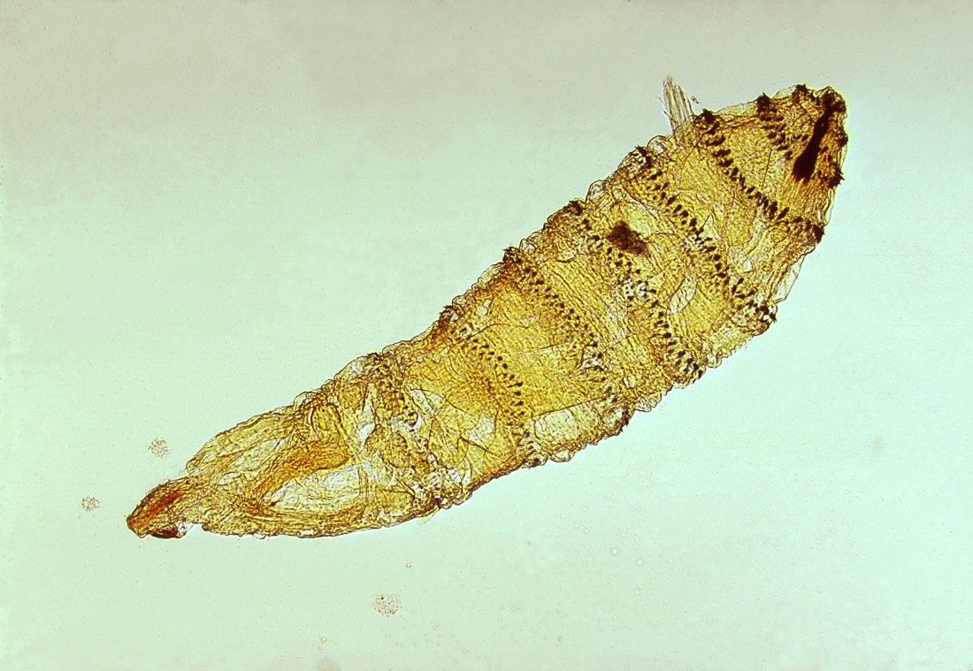 This is the larva of the <!-- raw HTML omitted -->Cuterebra<!-- raw HTML omitted --> botfly, a parasitic fly.