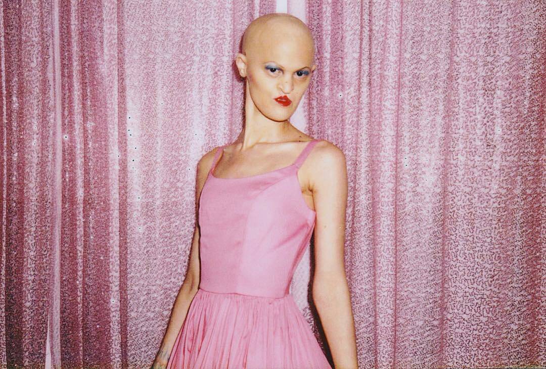 25 Incredible Photos Of Melanie Gaydos The Model With A Rare