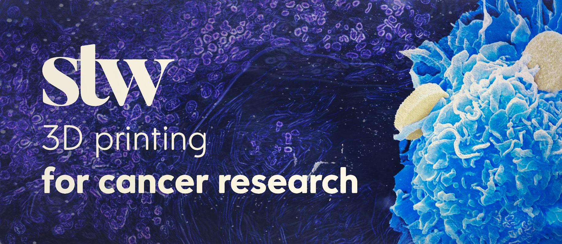 Scan the World and 3D Printing Contribute to Cancer Research MyMiniFactory Blog
