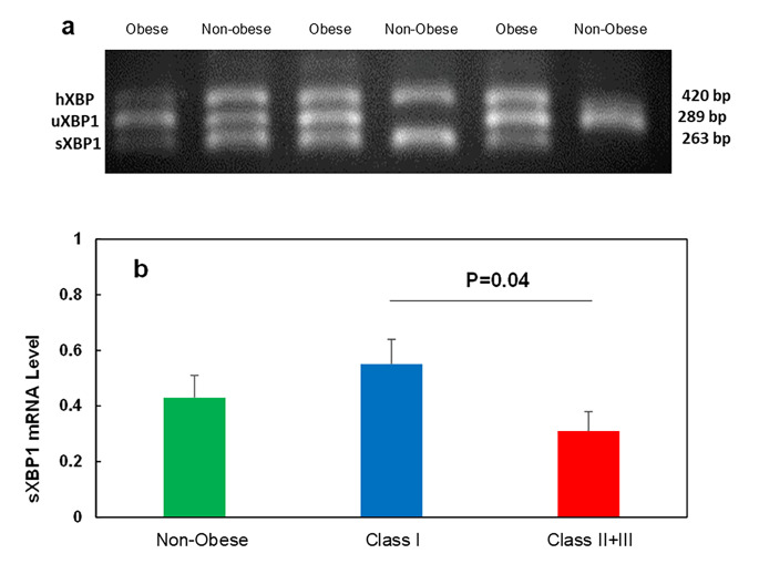 The size of human subcutaneous adipocytes, but not adiposity, is