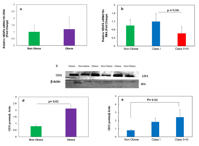 The size of human subcutaneous adipocytes, but not adiposity, is