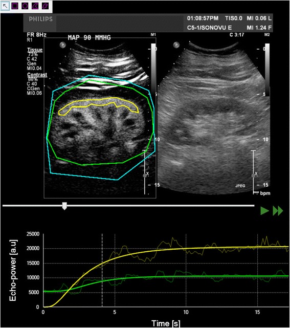 Contrastenhanced ultrasonography to evaluate changes in renal cortical