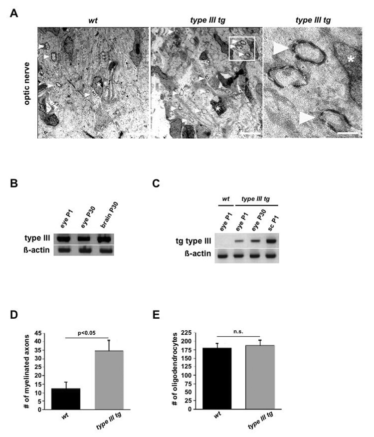 Neuregulin1/ErbB signaling serves distinct functions in myelination of