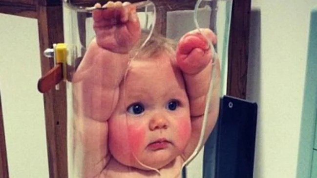 Baby in a tube Photo actually of xray machine