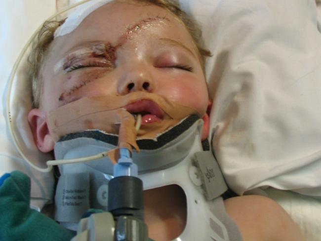 Layton Smith NSW government urged to change law to cover bizarre child