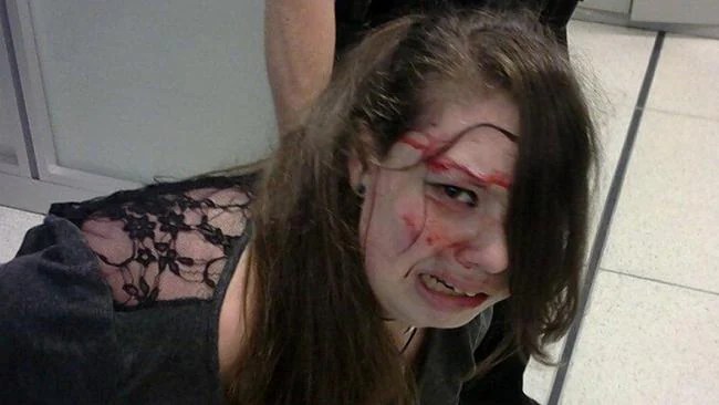 Disabled cancer survivor Hannah Cohen, 19, ‘assaulted by TSA agents’ at