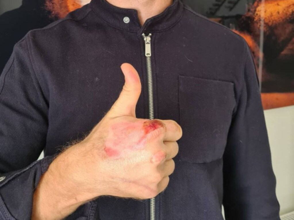 F1 news Romain Grosjean shows off scars from crash, Abu Dhabi Grand