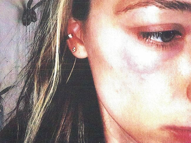 Johnny Depp alters Amber Heard ‘Scum’ tattoo again