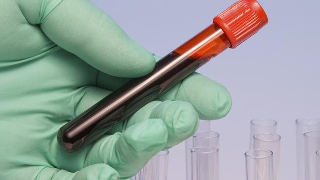 Defence Department to fund blood tests for Katherine residents who