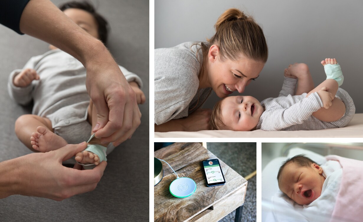 Owlet Baby Monitor burns baby's foot Kidspot