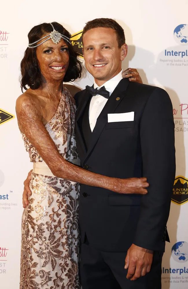 Turia Pitt talks about her fiance Michael in memoir ‘Unmasked’