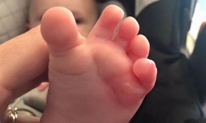 Owlet Baby Monitor burns baby's foot Kidspot