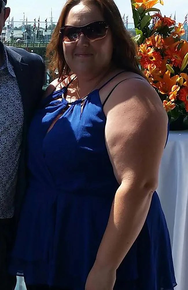 Weight loss before and after photos Minties addict sheds 70kg