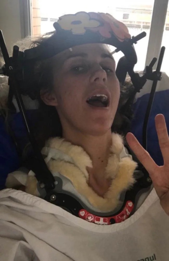 Monique Jeffrey broke her neck sneezing First Aid Training Canberra