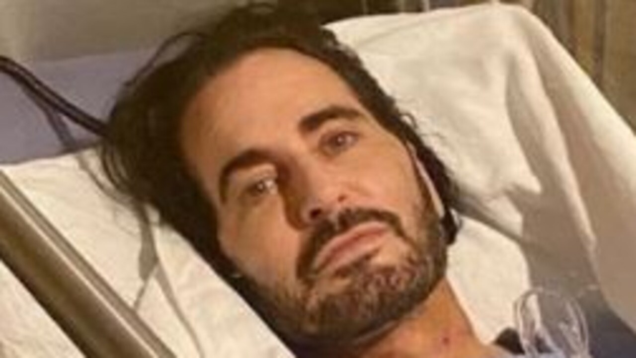 Marc Jacobs reveals results of facelift Australia News Lab