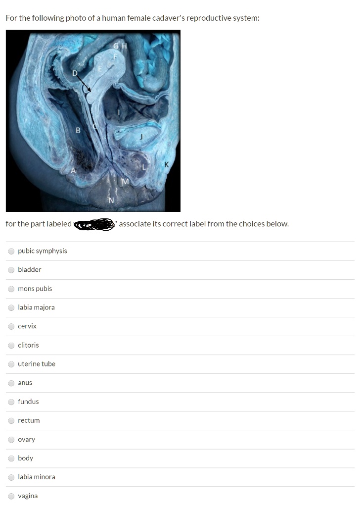 For the following photo of a human female cadaver's reproductive system