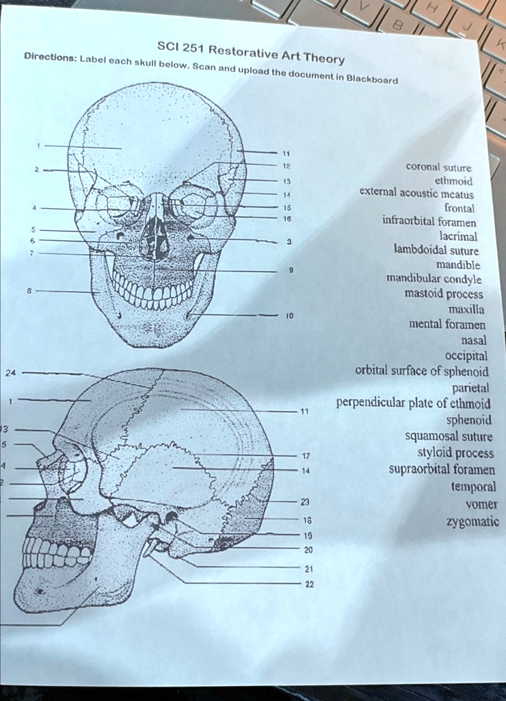 SOLVED SCI 251 Restorative Art Theory Directions Label each skull