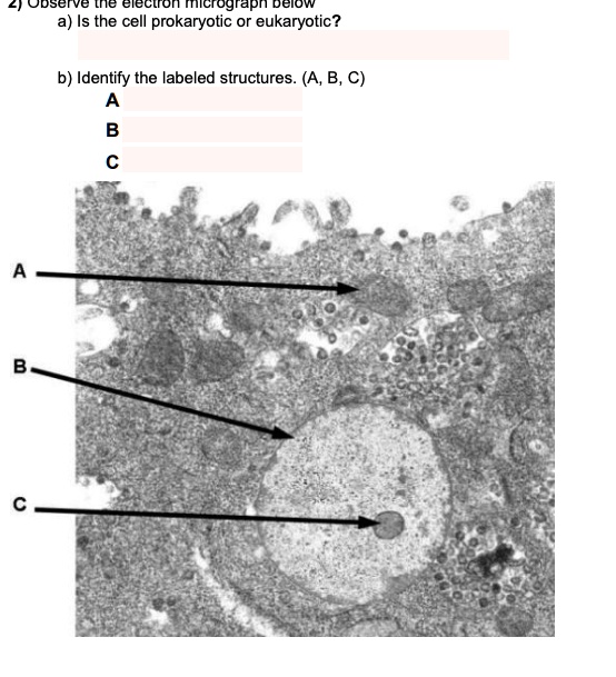 a) Is the cell prokaryotic or eukaryotic? b) Identify the labeled
