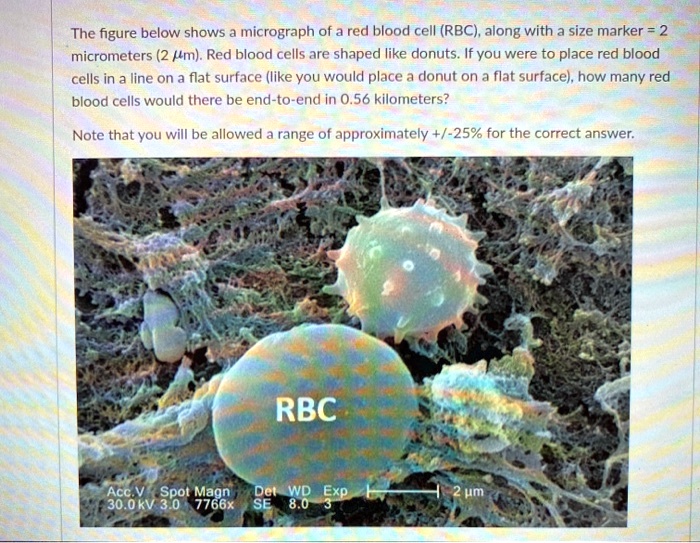prediksjon labyrint Mantle evig referendum fedme red blood cell size in