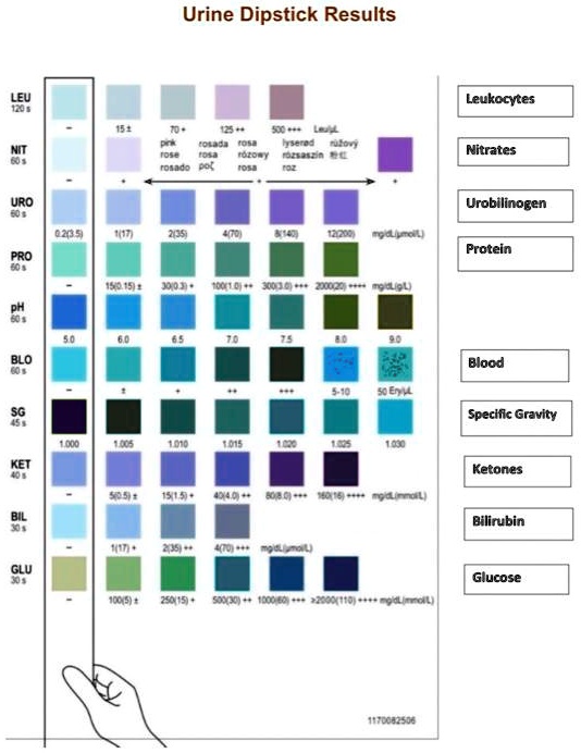SOLVED Urine Dipstick Results LEU Leukocytes 4 . = [Ol48d totoni F04C