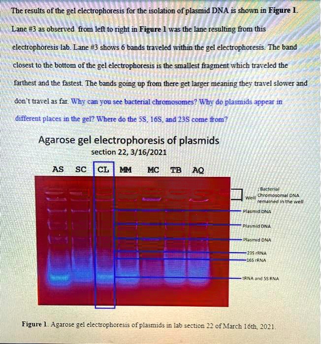 SOLVED The results of the gel electrophoresis for the isolation of