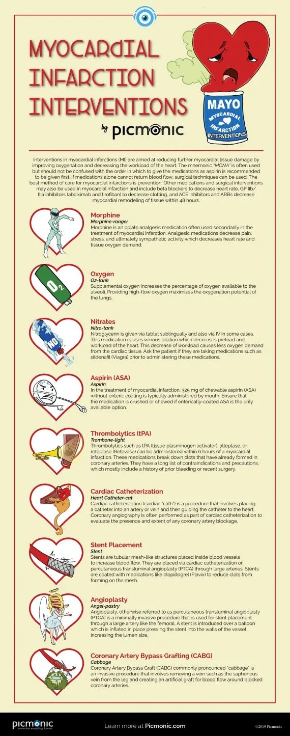 [Infographic] How to Study Myocardial Infarction Interventions Picmonic