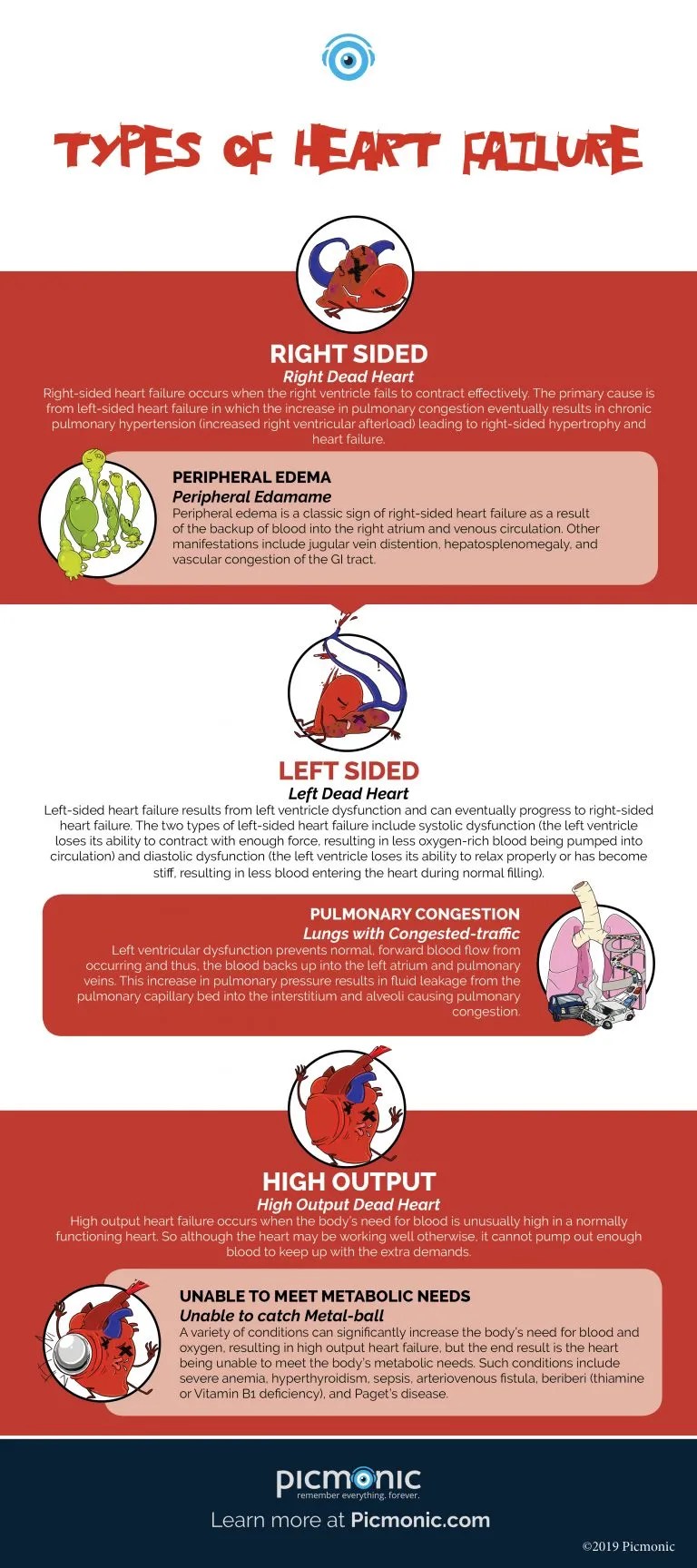[Infographic] How to Study Types of Heart Failure Picmonic