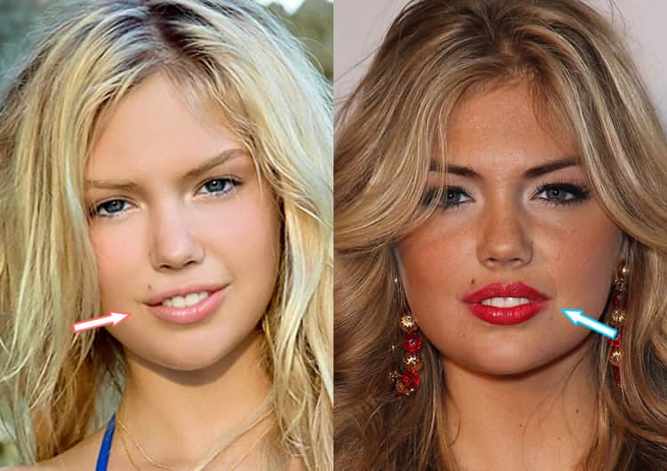 Kate Upton BEFORE and AFTER