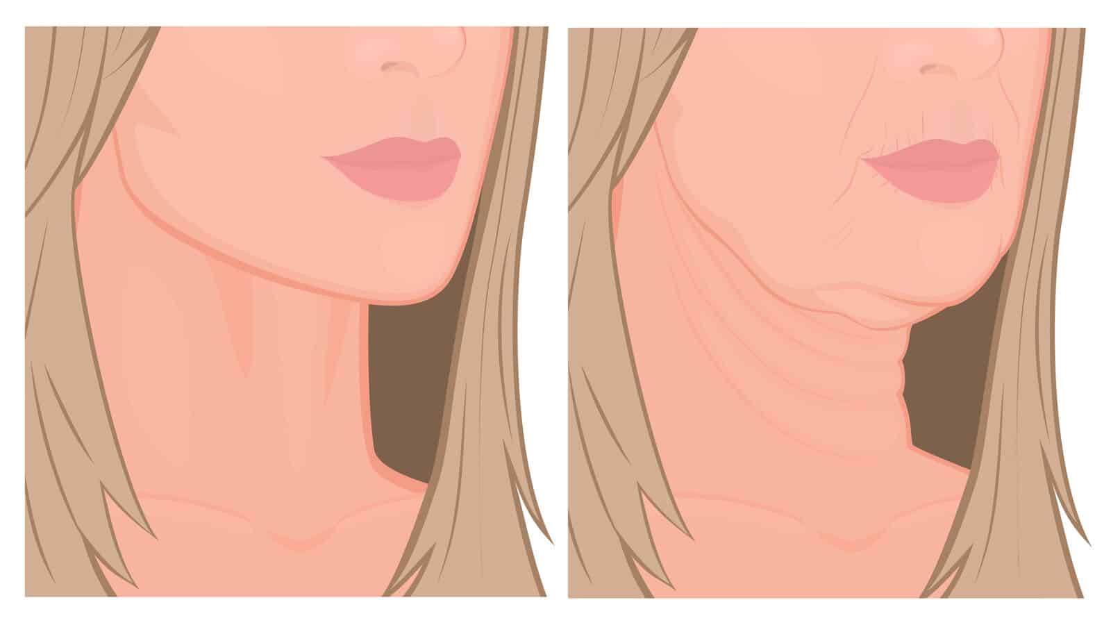 1280 x 720 jpeg 81 кб. Dermatologists Explain How To Prevent Sagging Jowls