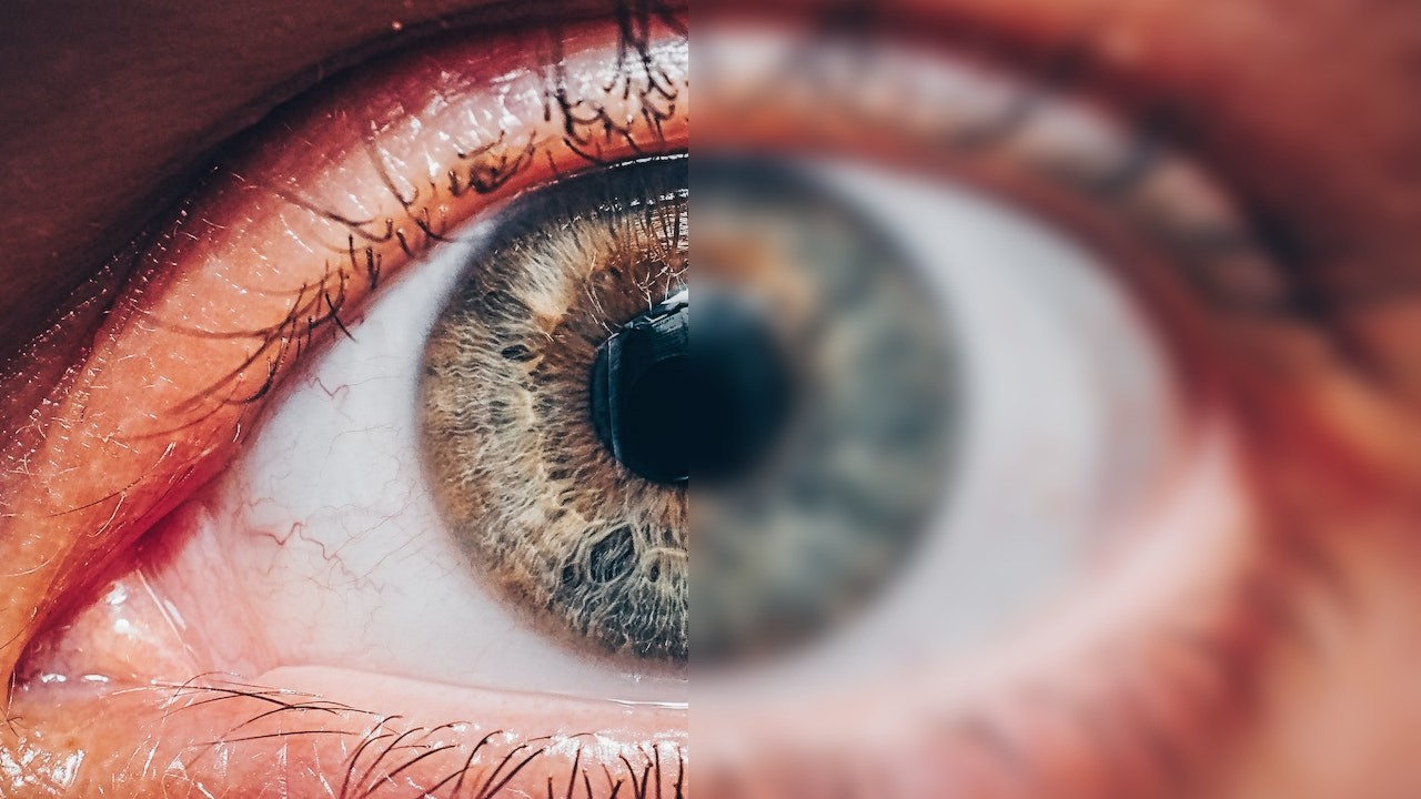 Eye Reflection Problems