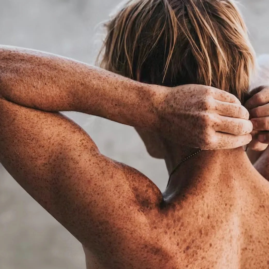 Skin + Mole Check Dunedin MoleMap New Zealand