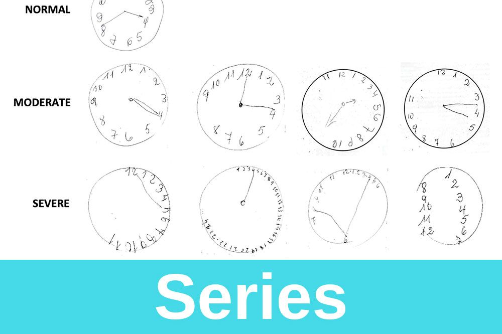 Clock Drawing Test Scoring Pdf Bruin Blog