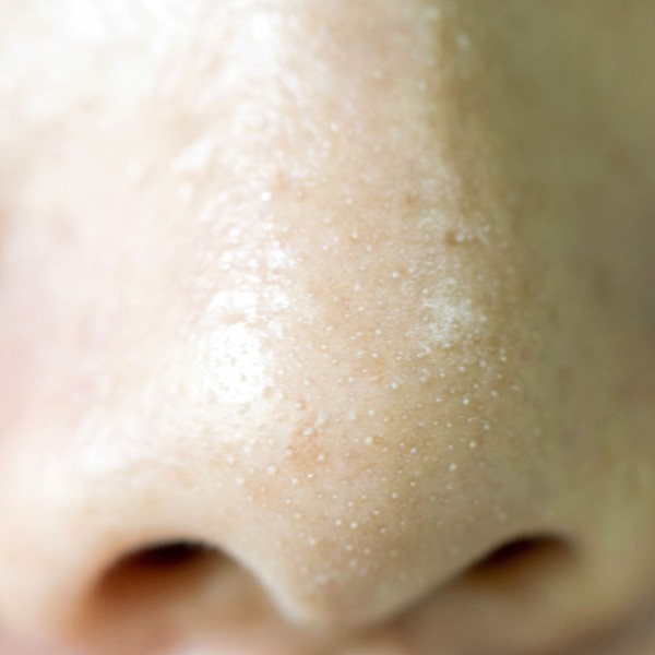 Por qué me salen pequeños puntos blancos en los labios