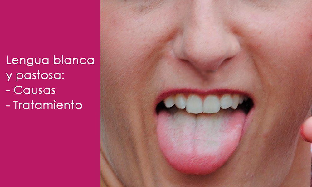 QuÃ© significa tener la lengua blanca y pastosa