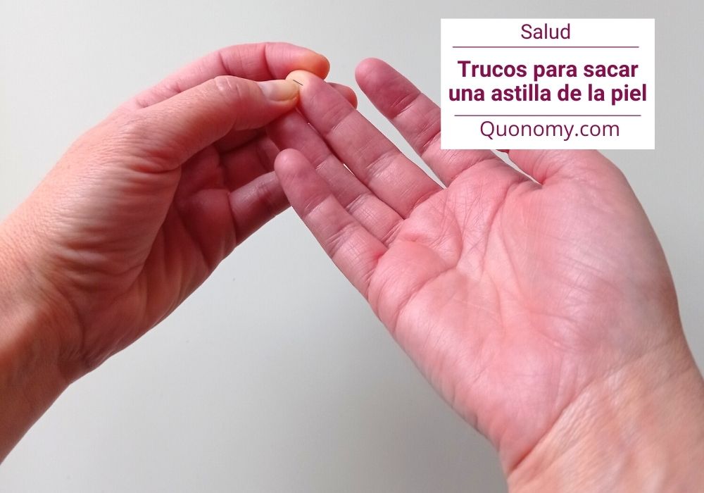 Cómo sacar una astilla de la piel (trucos útiles cuando las pinzas fallan)