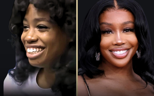Szas Major Glowup The Impact Of Sza Plastic Surgery On Her Look