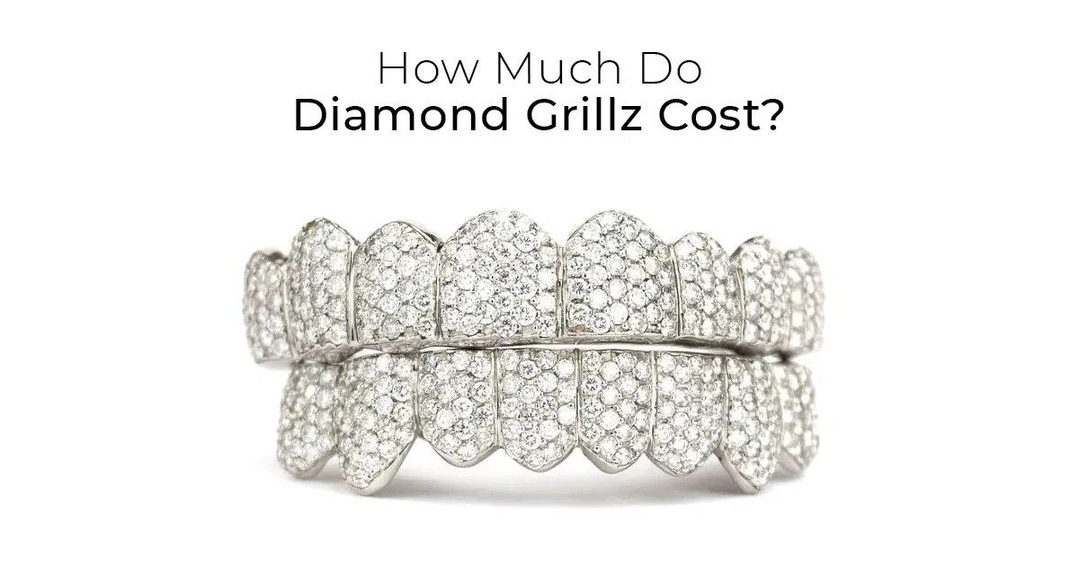 How Much Are Diamond Grillz? RRP Diamond