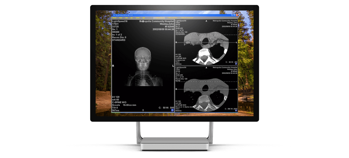 TeleRadiology Application Custom Desktop Applications Scopic