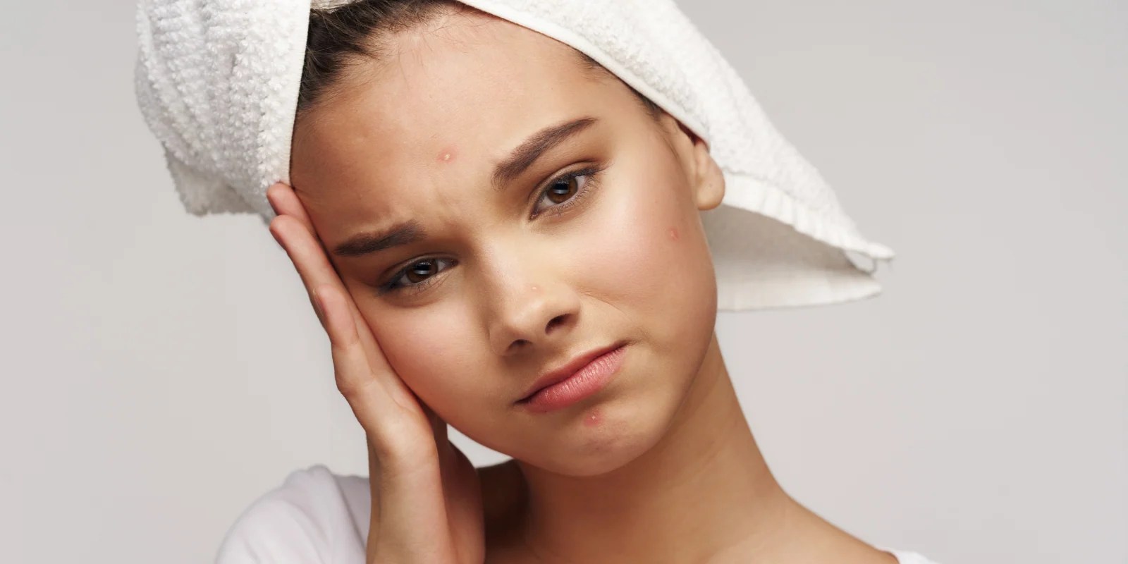 How Do I Get Rid Of A Pimple Overnight? AcneFree