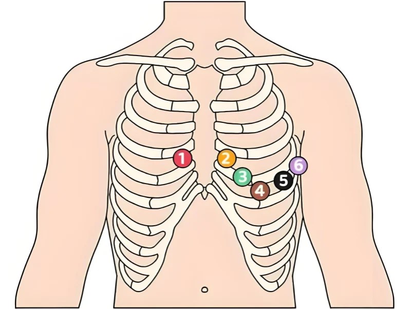 Master 3Lead, 5Lead & 12Lead ECG Placement—Electrode Map Inside!