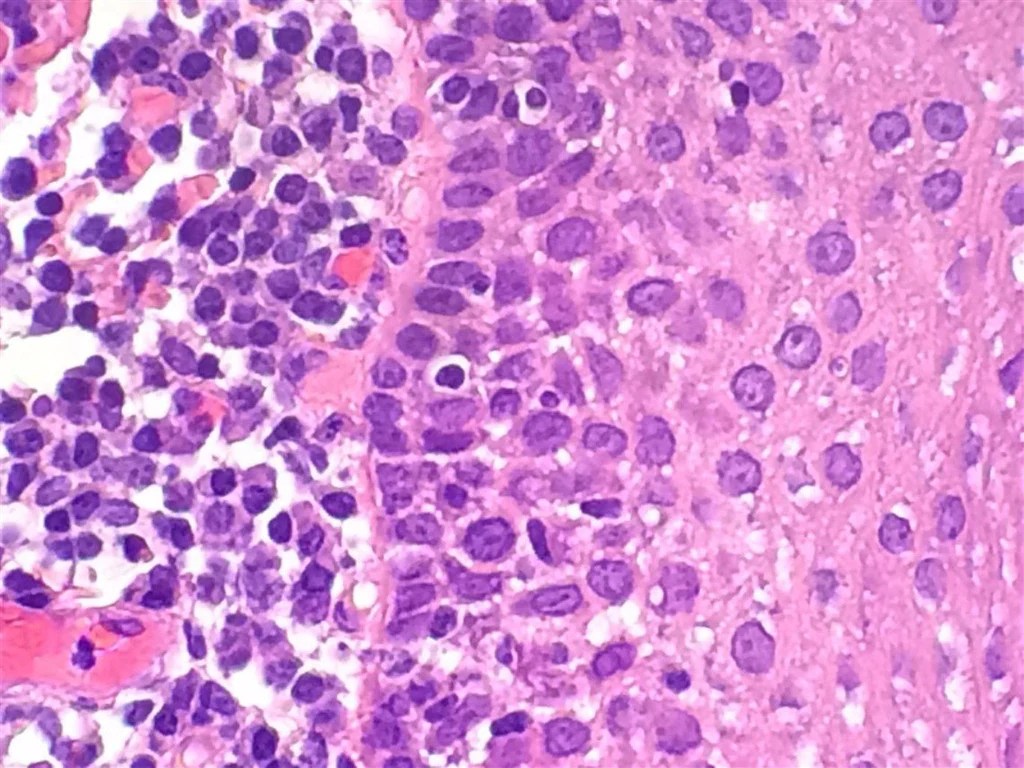H&E Stain Kit, Hematoxylin (Ehrlichs) Eosin (BZ0921) Benz Microscope