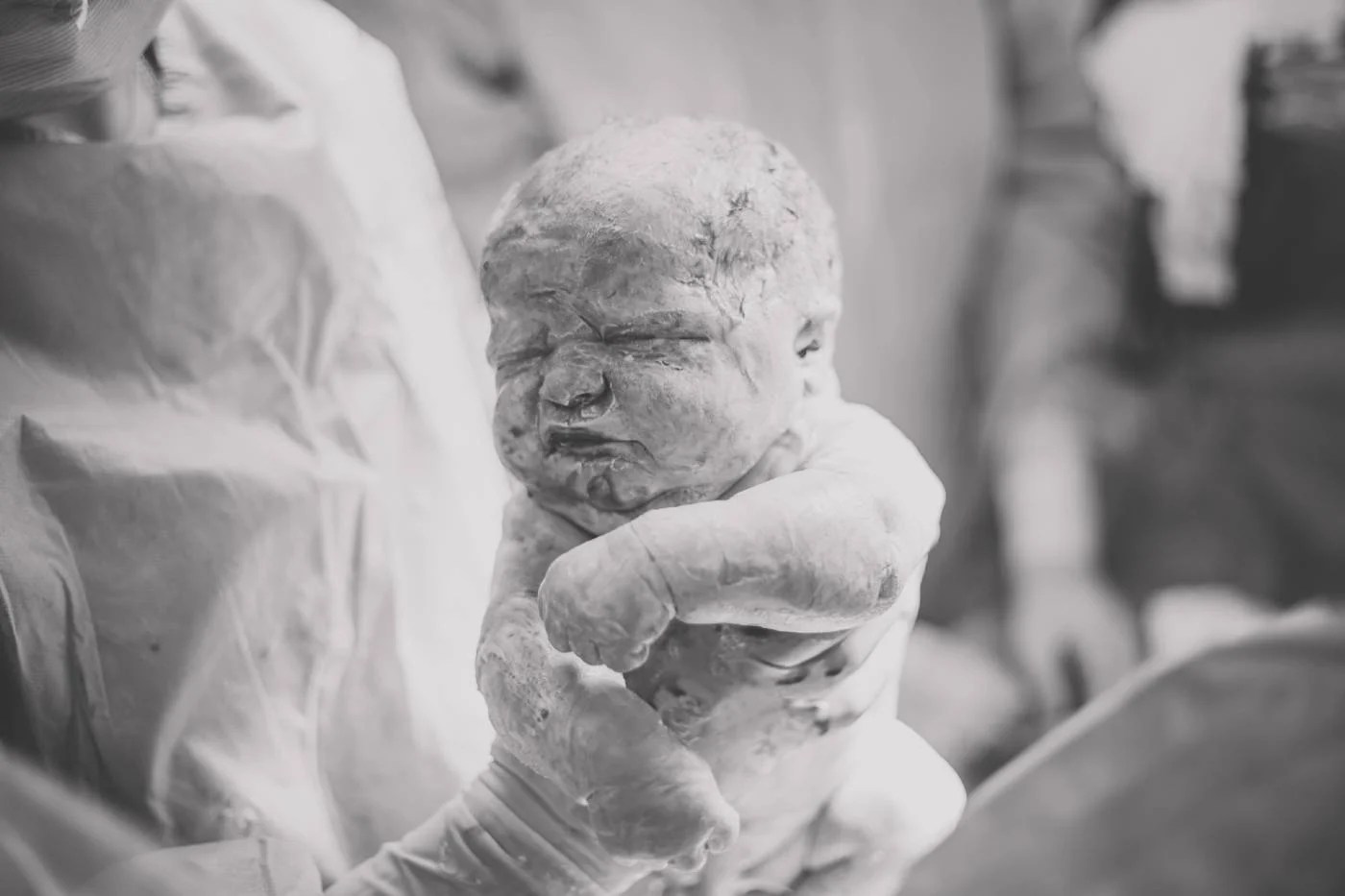 Vernix What You Need to Know Happiest Baby