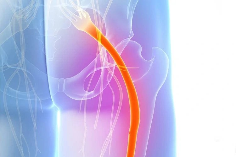Pregnancy and Sciatic Nerve Pain American Pregnancy Association