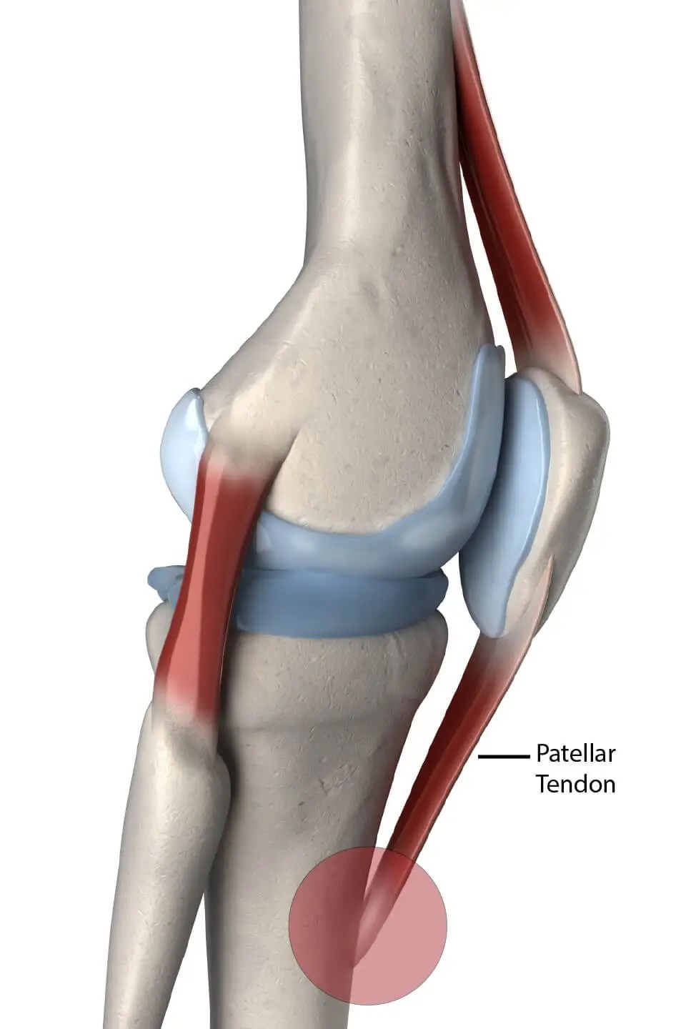 Jumper's Knee (OsgoodSchlatter's Disease) Balance Health Center