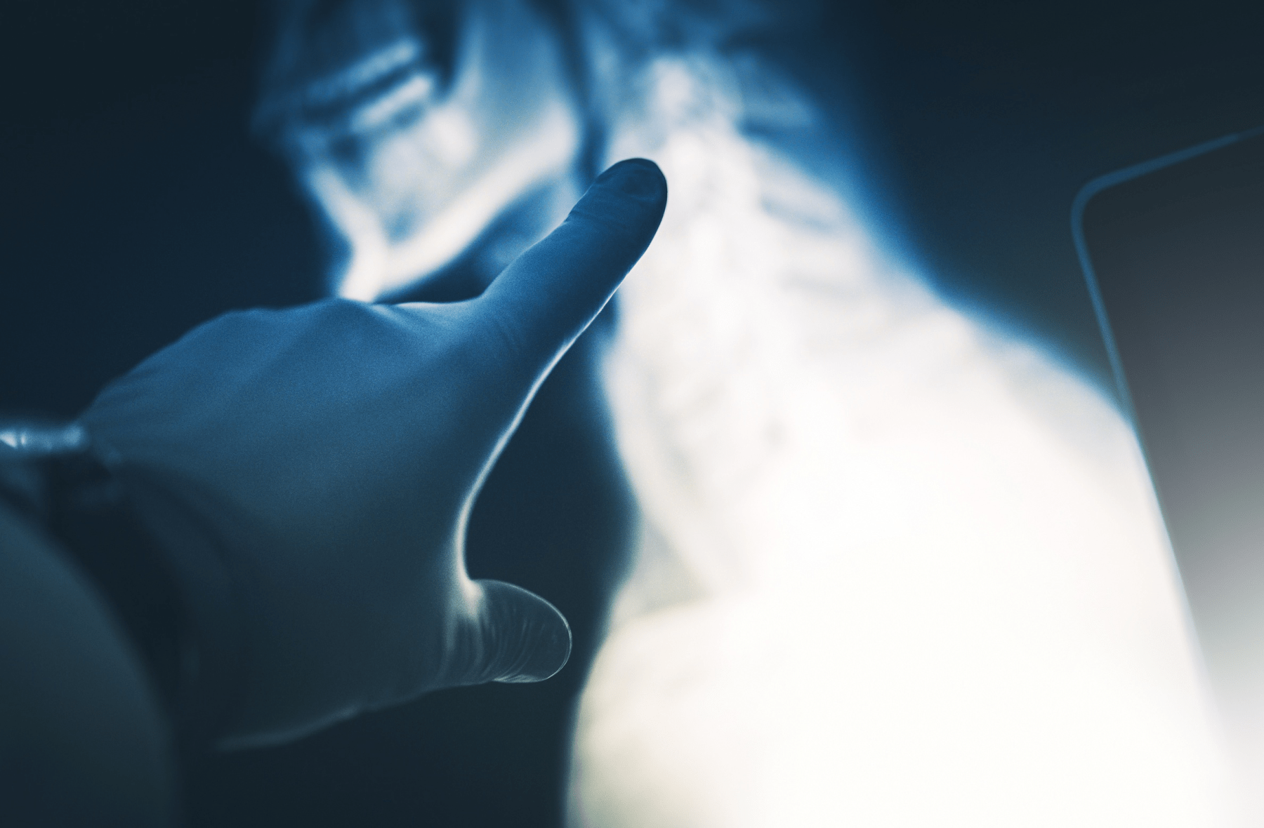 Radiolog Poznań USG piersi, badanie węzłów chłonnych