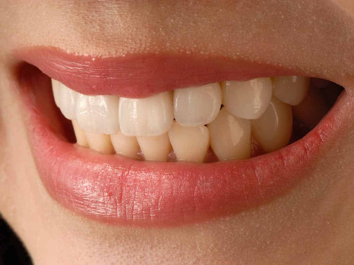 New teeth gel may prevent dental cavities, tooth decay