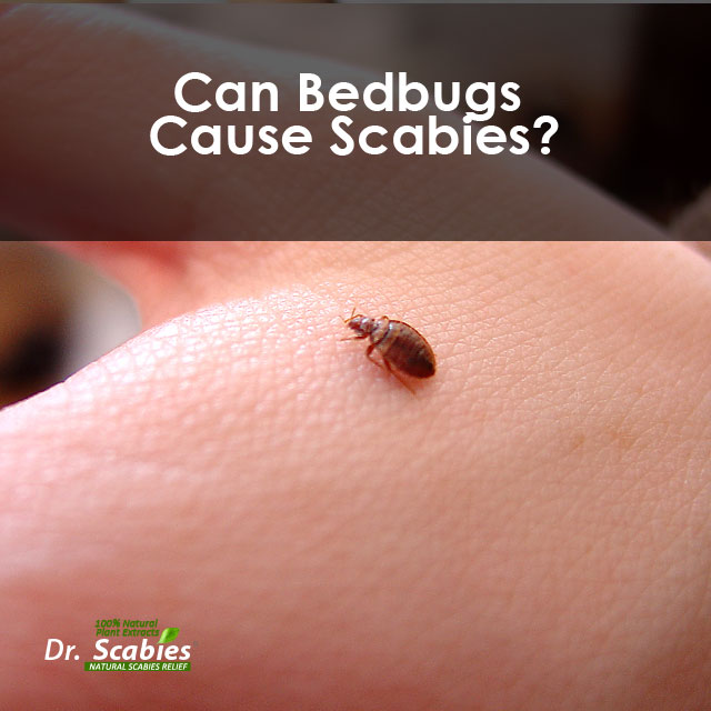 How Long Will Lice Live On Bedding How Long Can Scabies Mites Survive Without A Human Host? Sleepation