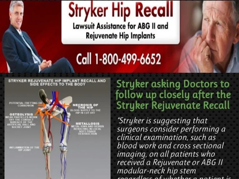 Stryker hip lawsuit