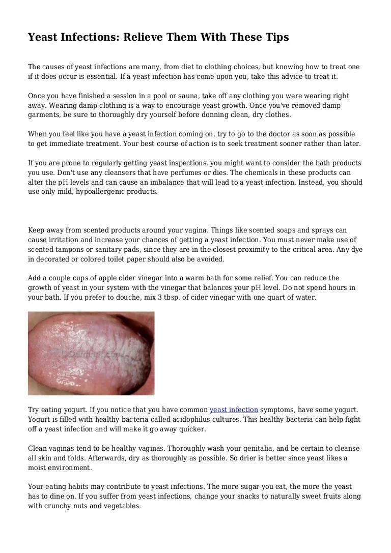 Does Eating Yogurt Help Yeast Infection Examples and Forms