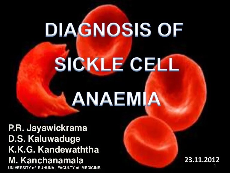 Diagnosis sickle cell anemia